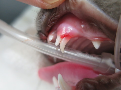 歯槽骨、歯根の一部の溶解