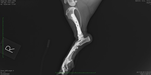 右足のレントゲン画像